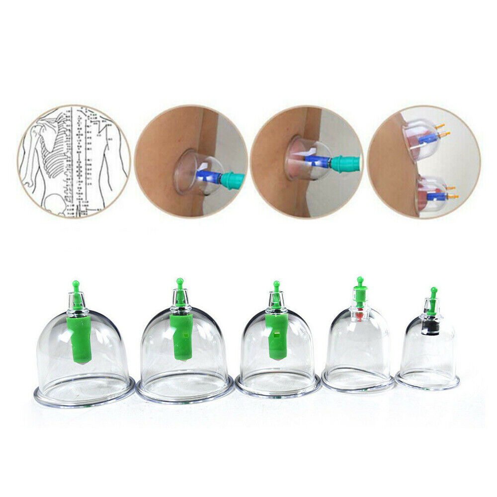 24 Cups Vacuum Cupping Therapy Set Kit Chinese Massage Acupuncture Suction AU