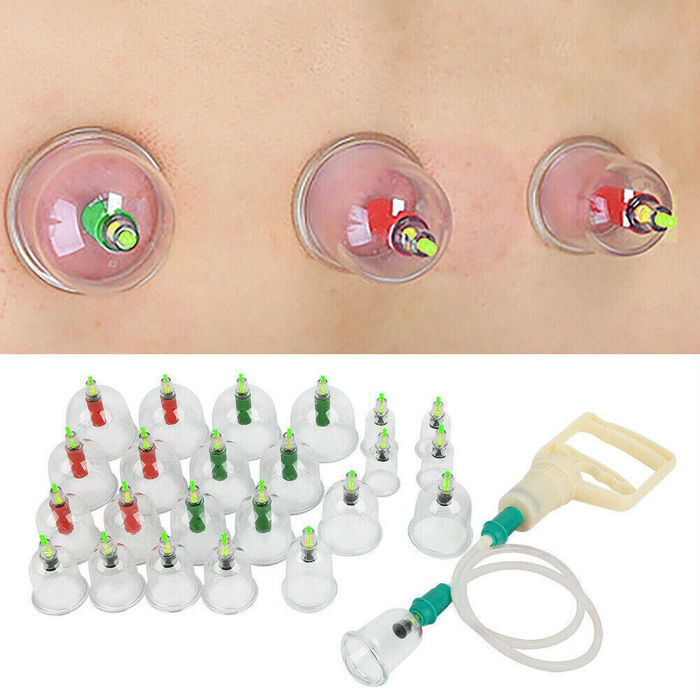 24 Cups Vacuum Cupping Therapy Set Kit Chinese Massage Acupuncture Suction AU